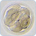 分割胚(8分割胚)