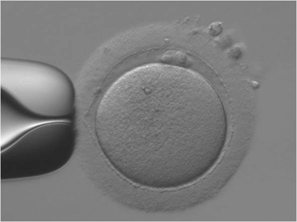 通常の顕微鏡で観察した成熟卵子