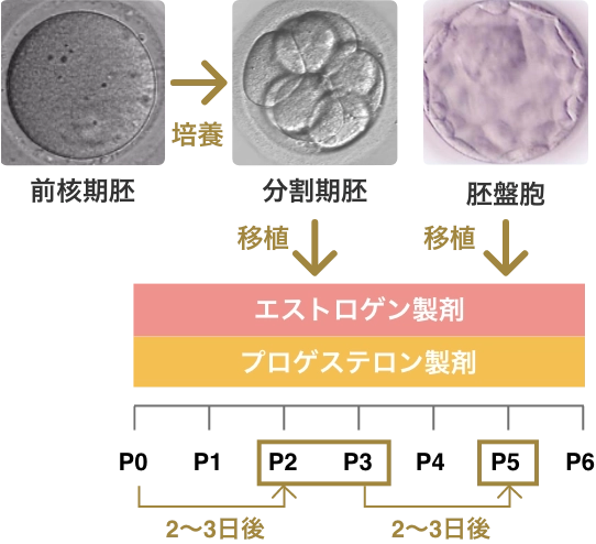 二段階胚移植法