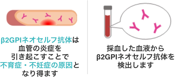 β2GPIネオセルフ抗体