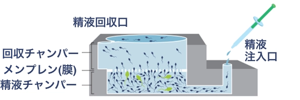 ZyMōt(ザイモート)スパームセパレーター