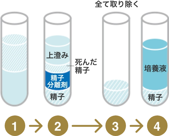密度勾配遠心法