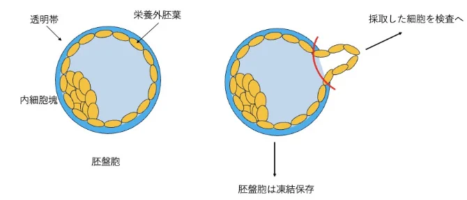 着床前遺伝学的検査(PGT)