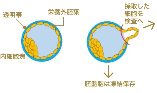 胚盤胞