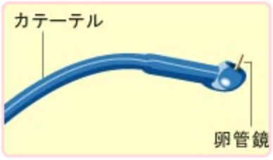 卵管鏡下卵管形成術で使用するカテーテルと卵管鏡のイラスト