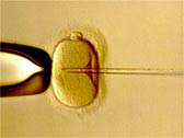 顕微授精の画像